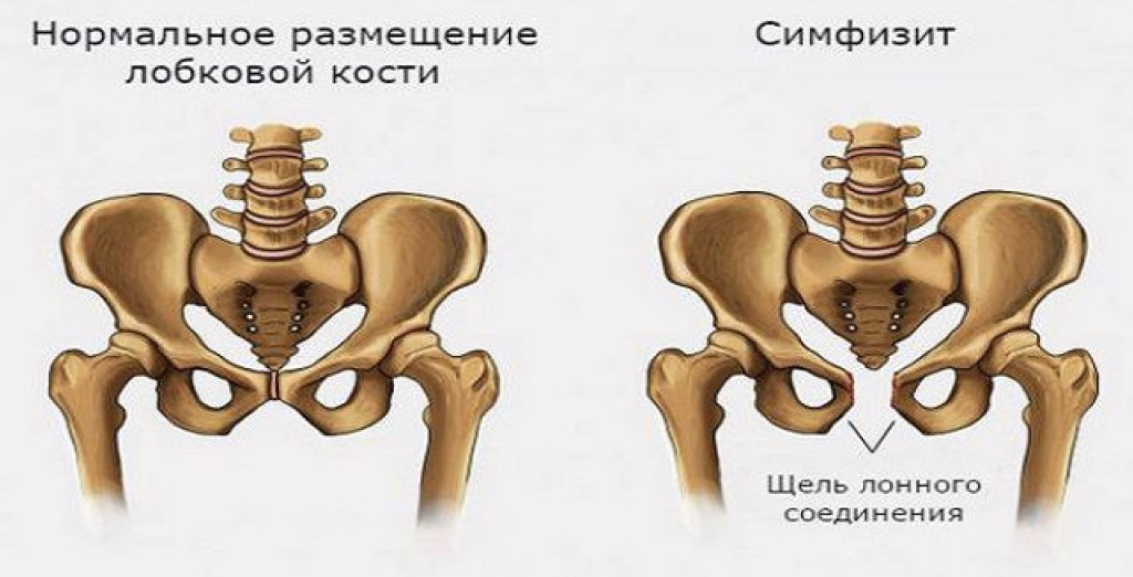 Вторая беременность: легче или сложнее?